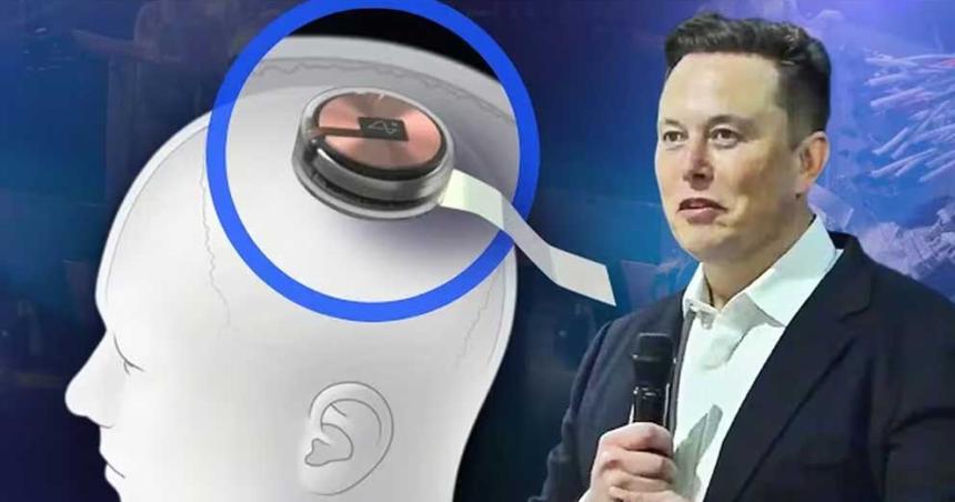 Coacutemo funciona el chip cerebral de Elon Musk que controla dispositivos con el pensamiento