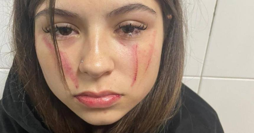 Una joven de 15 antildeos fue agredida brutalmente por un grupo de chicas