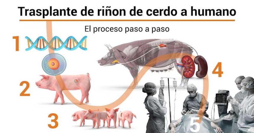 Trasplante de oacuterganos de cerdo en humanos- aprueban el primer ensayo cliacutenico en EEUU