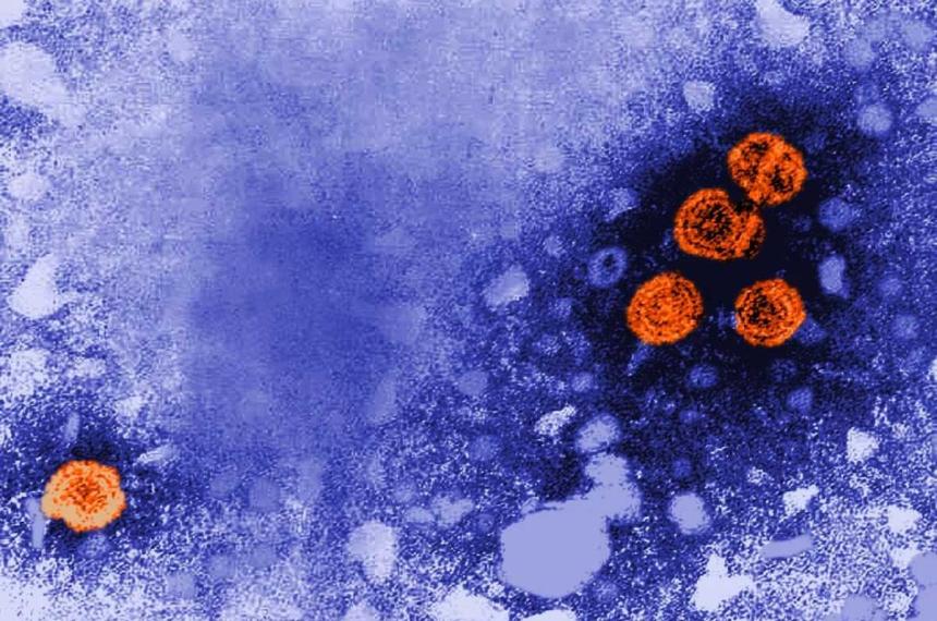 Hepatitis B- identificaron un mecanismo clave en la infeccioacuten y podriacutea usarse contra el herpes y el VPH